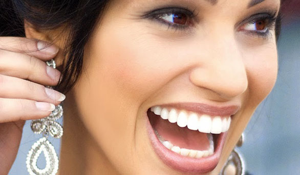 Different Methods for Teeth Whitening